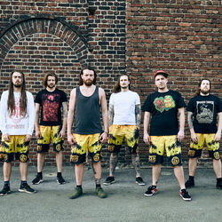 Picture of Stillbirth