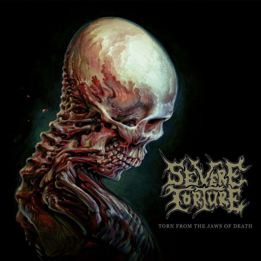 Picture of Severe Torture