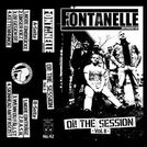 Fontanelle