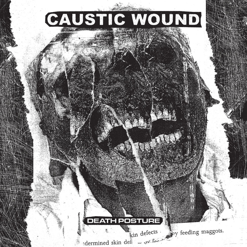 Picture of Caustic Wound