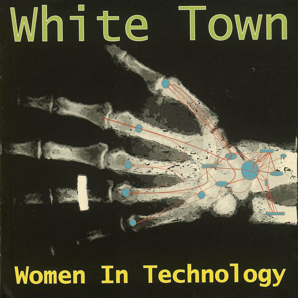 Photo de l'artiste White Town