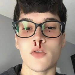 Picture of NAX