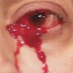 Picture of BabyCorpse
