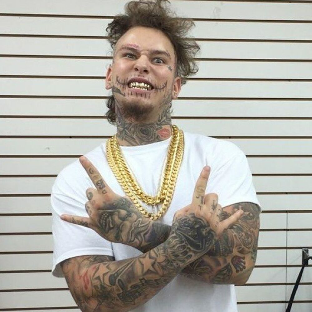 Picture of Stitches