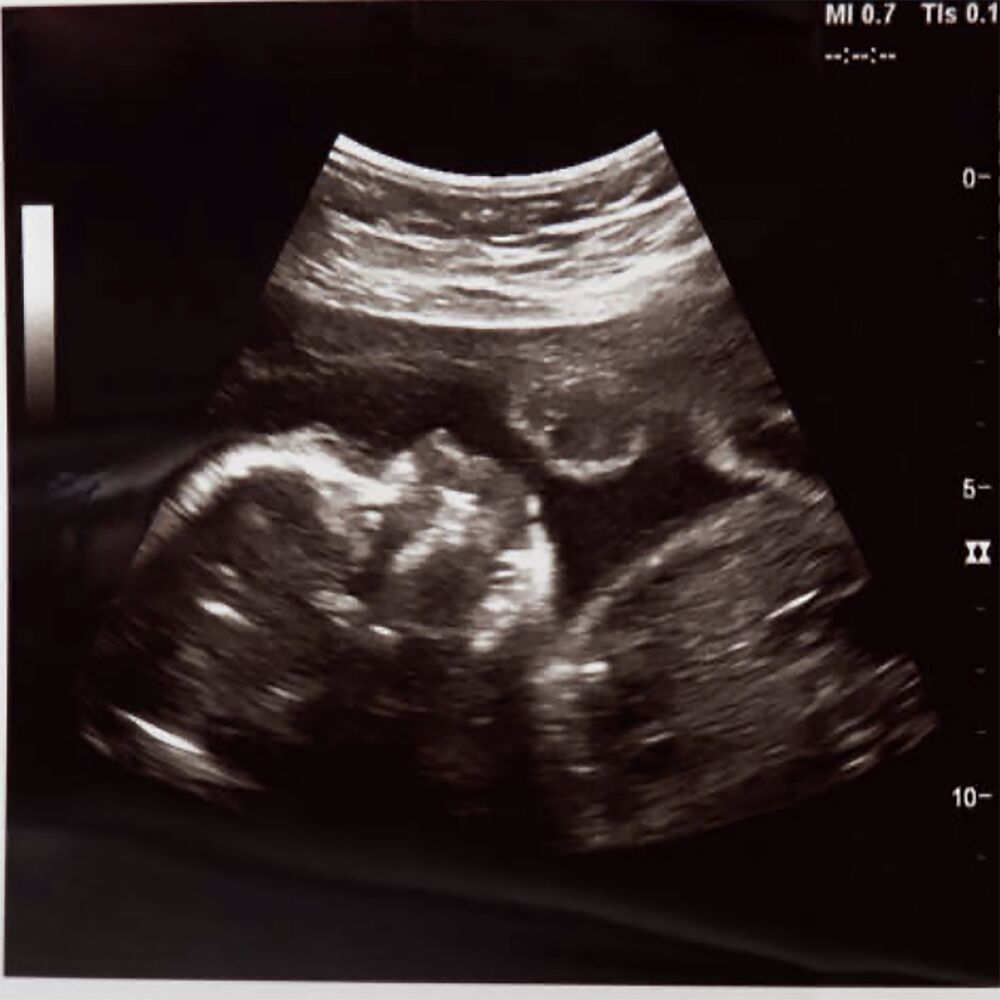 Picture of Womb Sounds