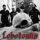 Lobotomia
