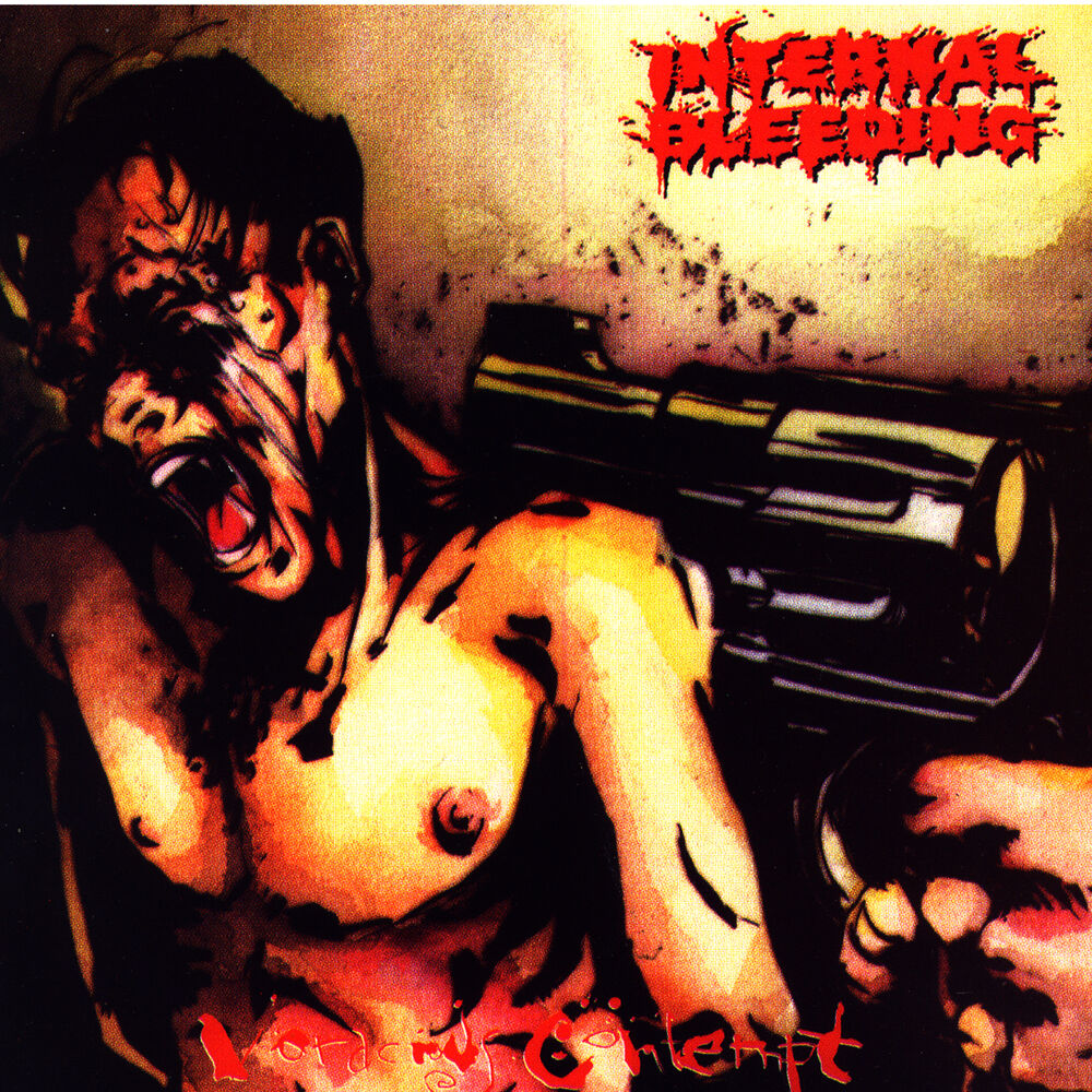 Picture of Internal Bleeding