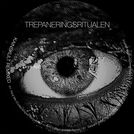 Trepaneringsritualen