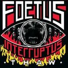 Foetus Interruptus