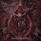 Vulvectomy