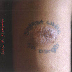Cover of Scars & Memories