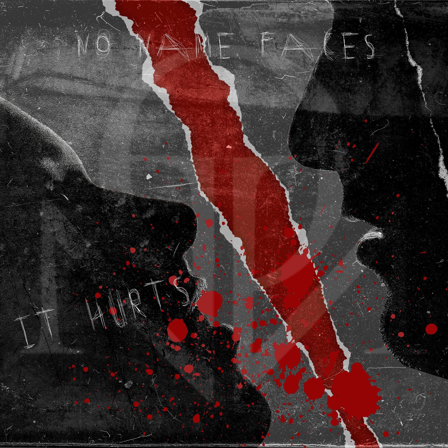 Album cover of It Hurts