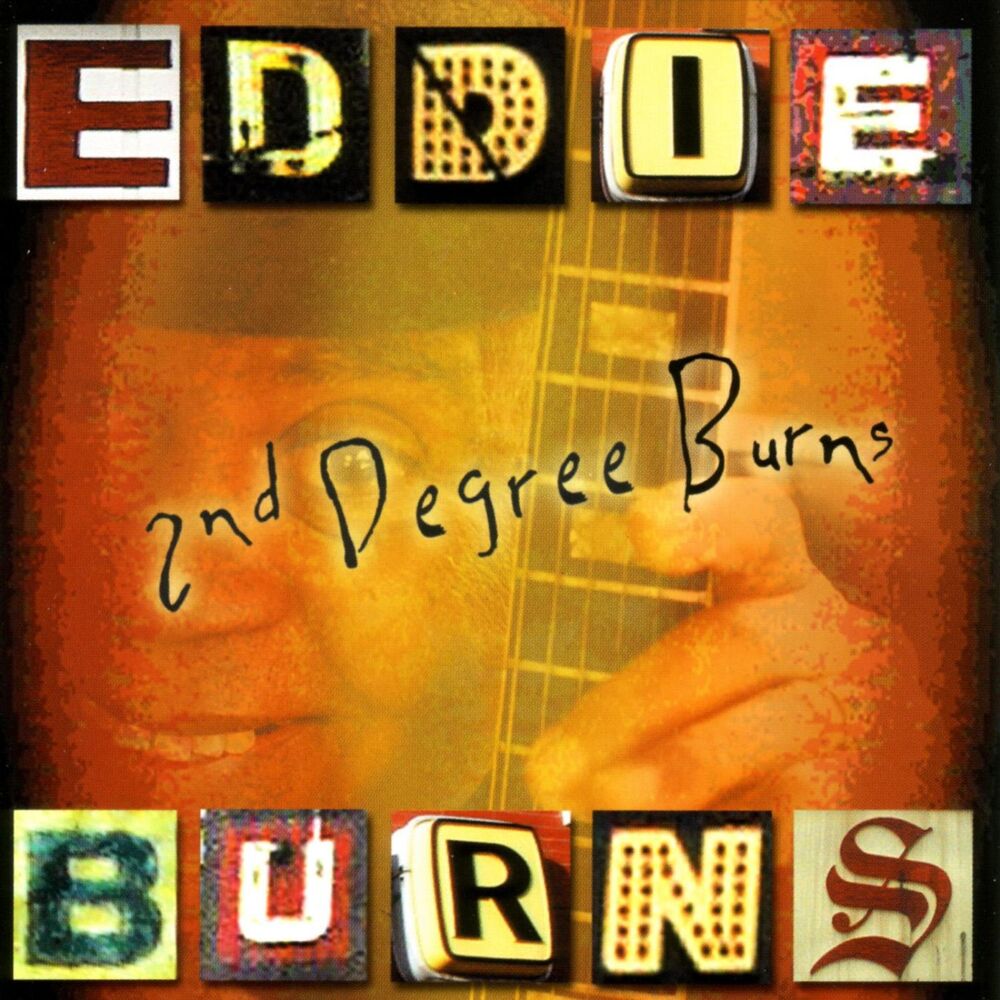 Picture of 2nd Degree Burns