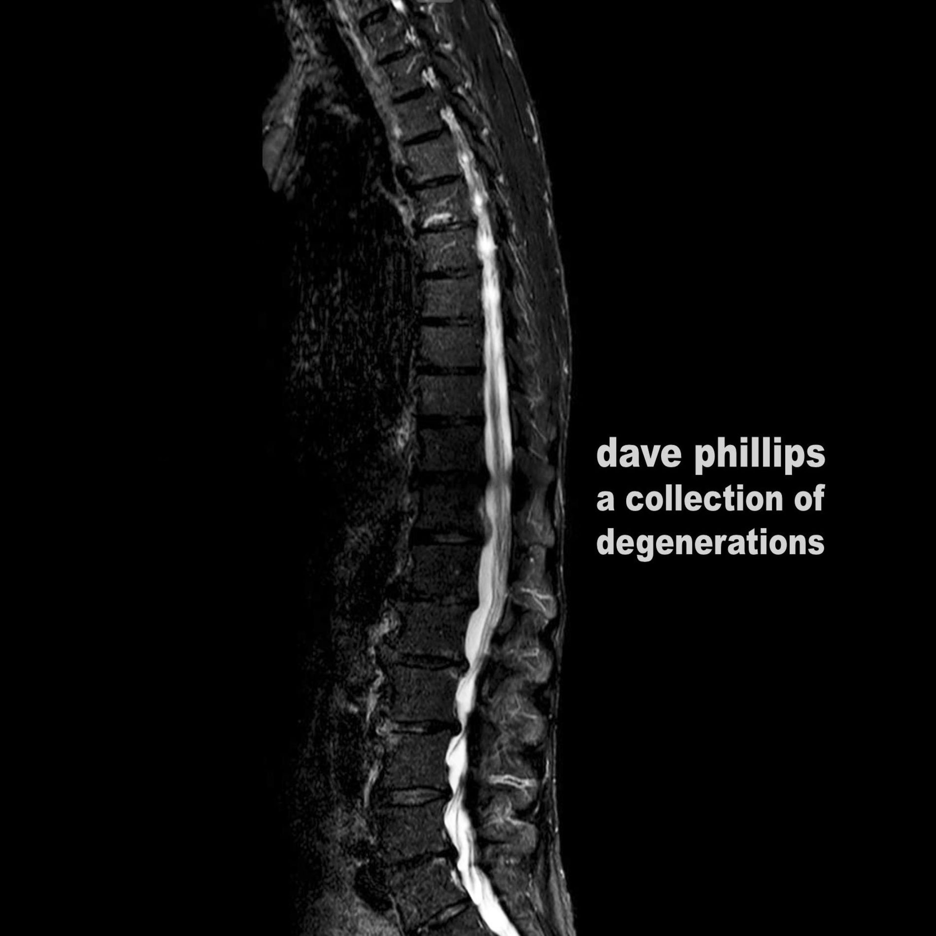 Album cover of A Collection of Degenerations