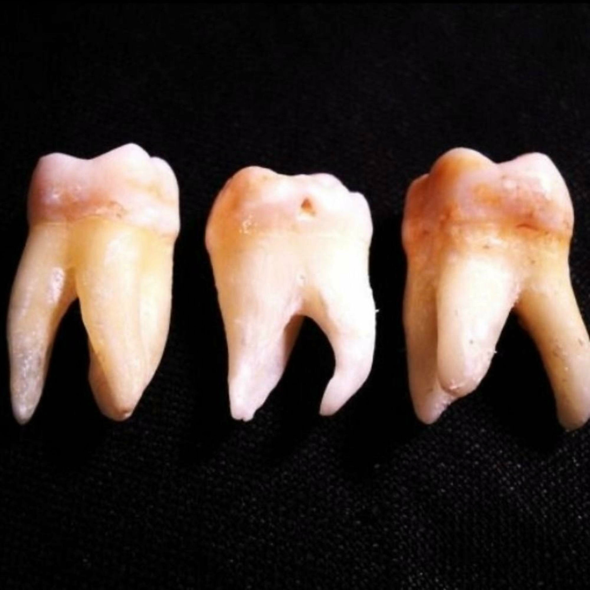 Album cover of LES DENTS QUI TOMBENT
