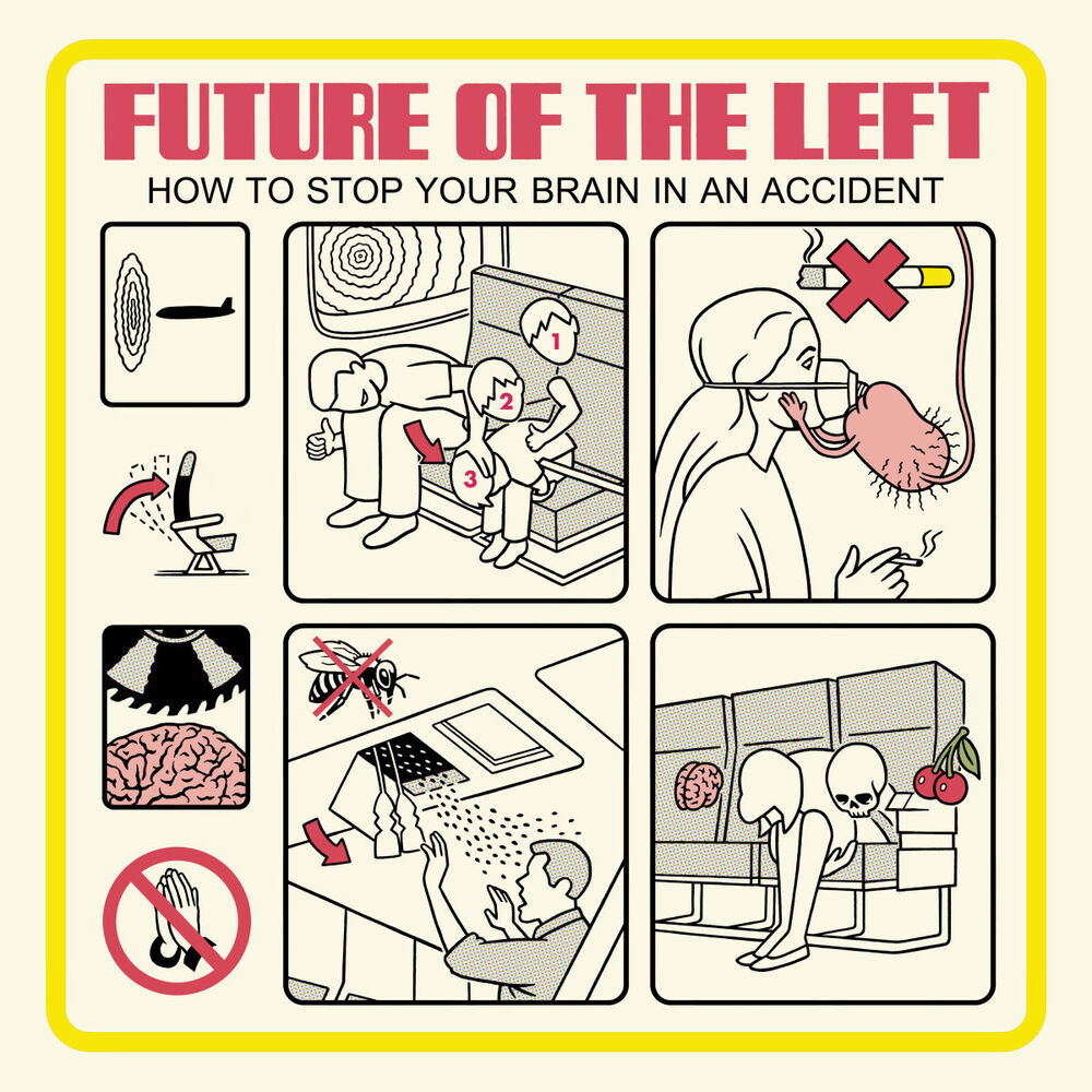Picture of How To Stop Your Brain In An Accident