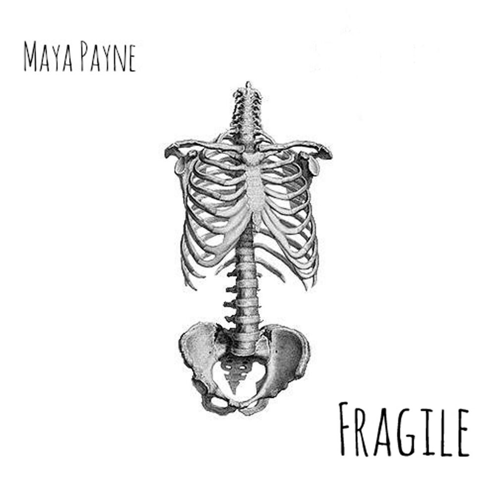 Picture of Fragile