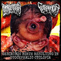 GERIATRIC BIRTH RESULTING IN OTOCEPHALIC CYCLOPIA