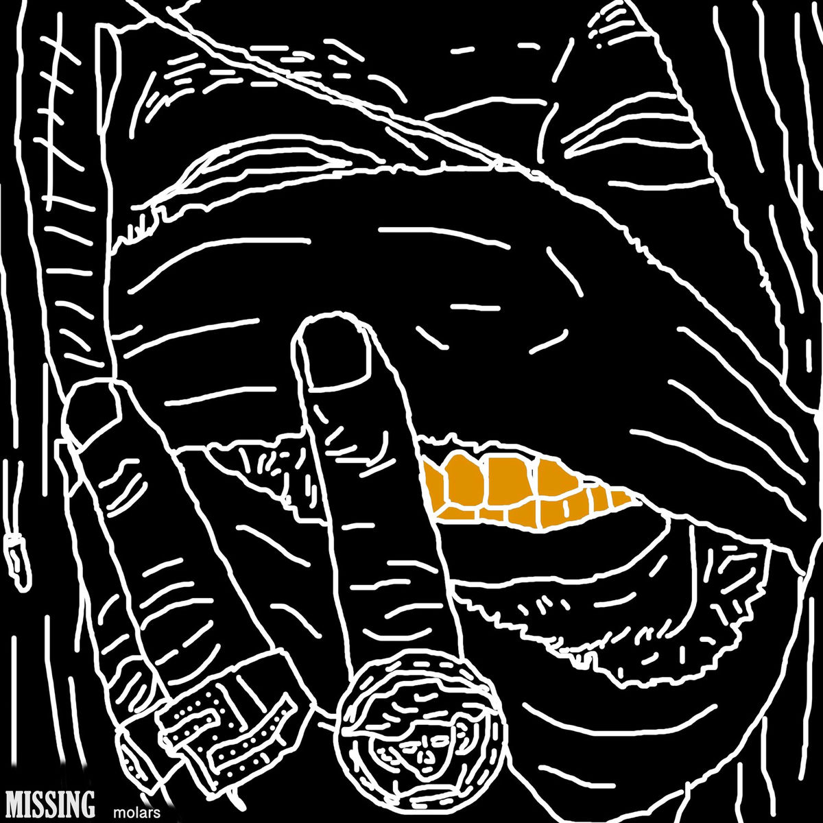 Album cover of Missing Molars (SWNT Deluxe)