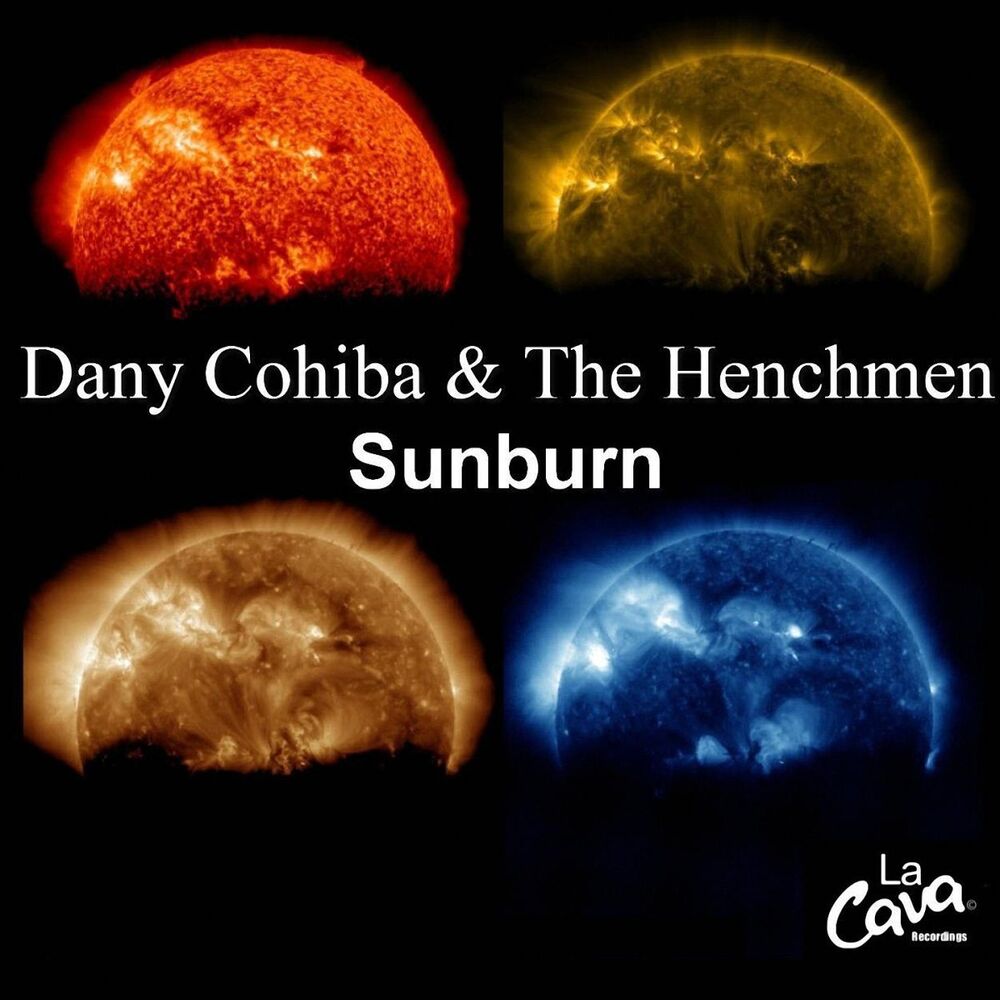 Picture of Sunburn