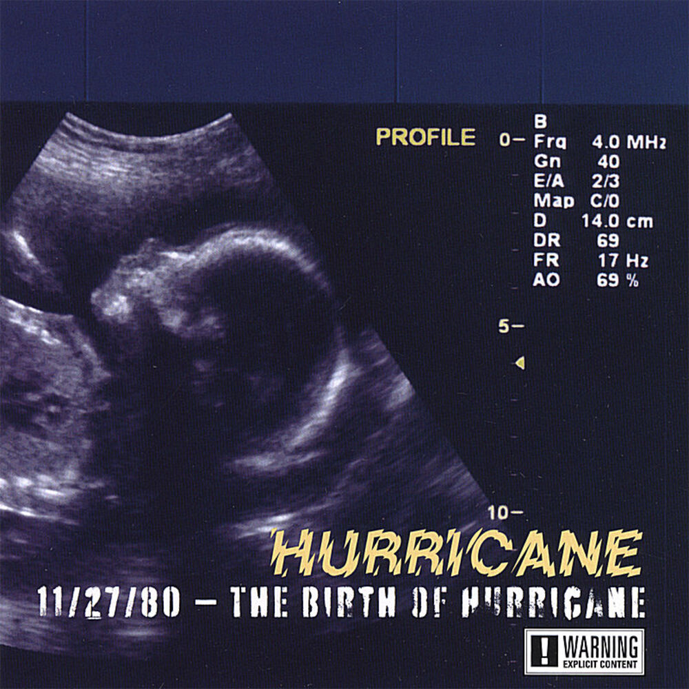 Picture of The Birth Of Hurricane