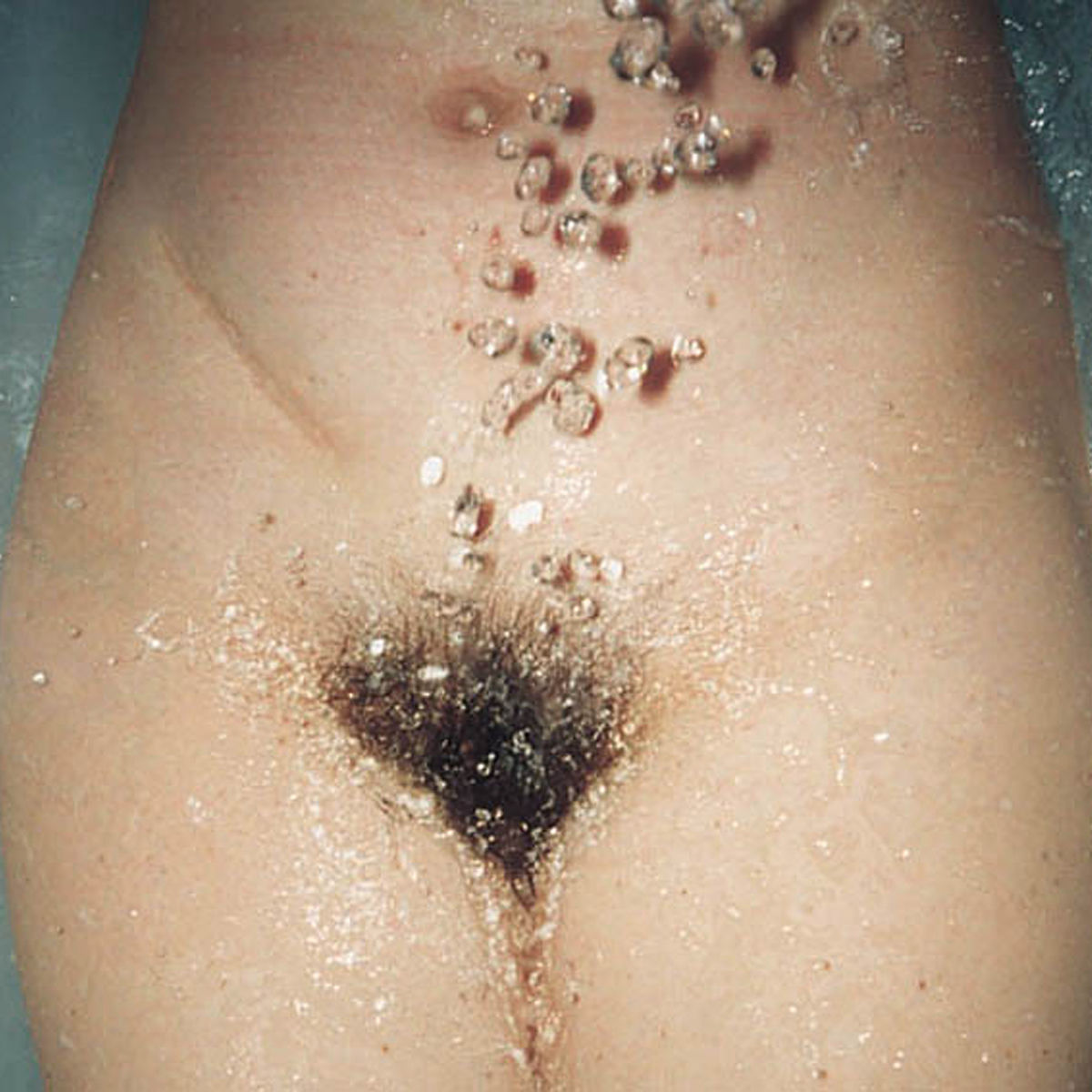 Album cover of Kaltes Klares Wasser