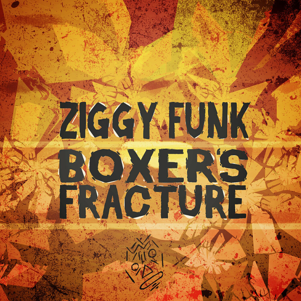 Picture of Boxer's Fracture
