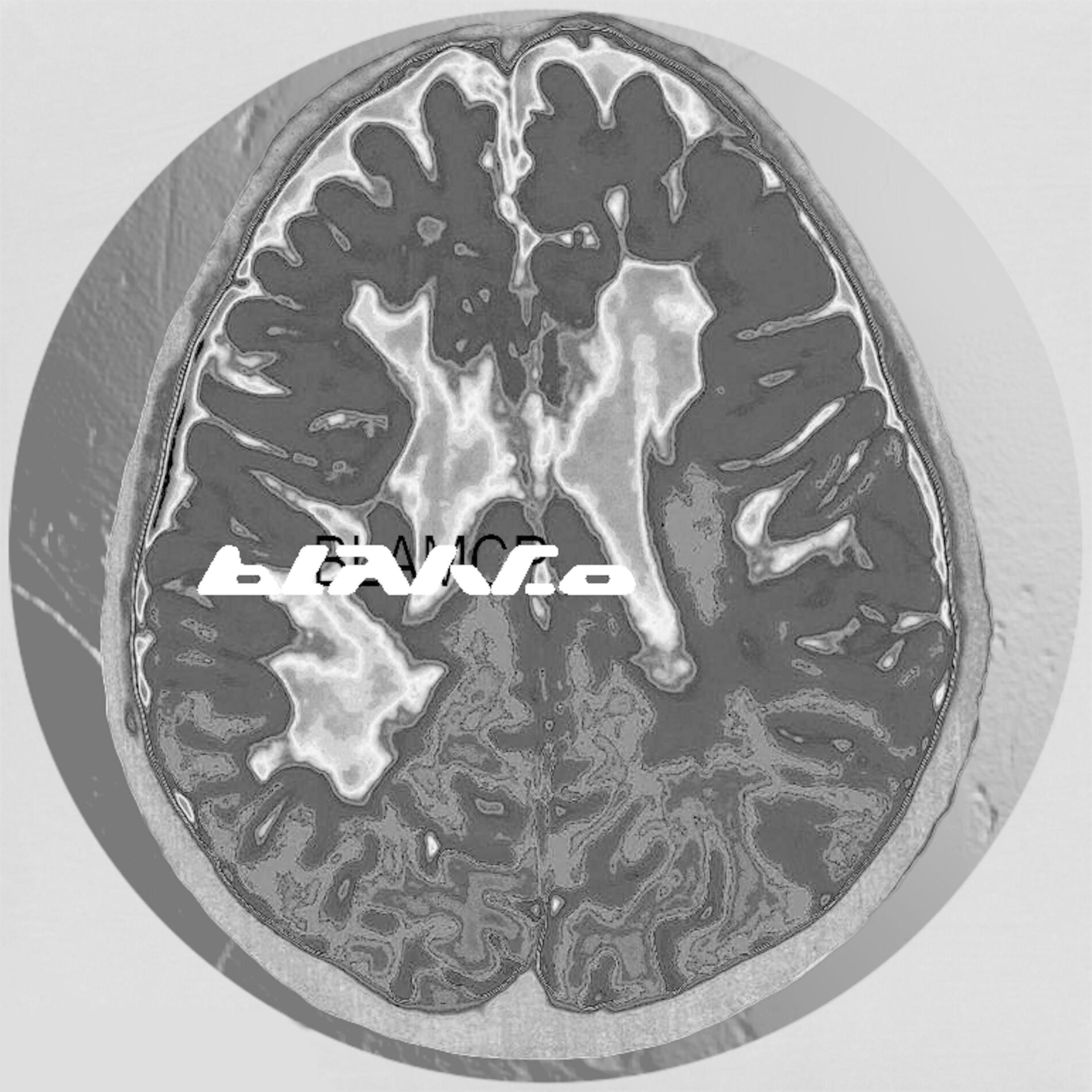 Album cover of System#01000111
