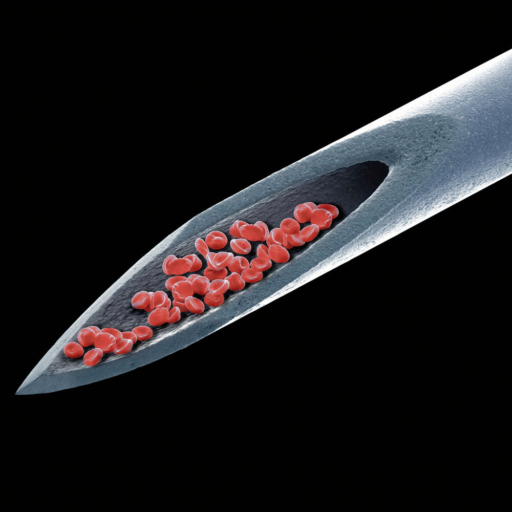 Picture of Live Blood