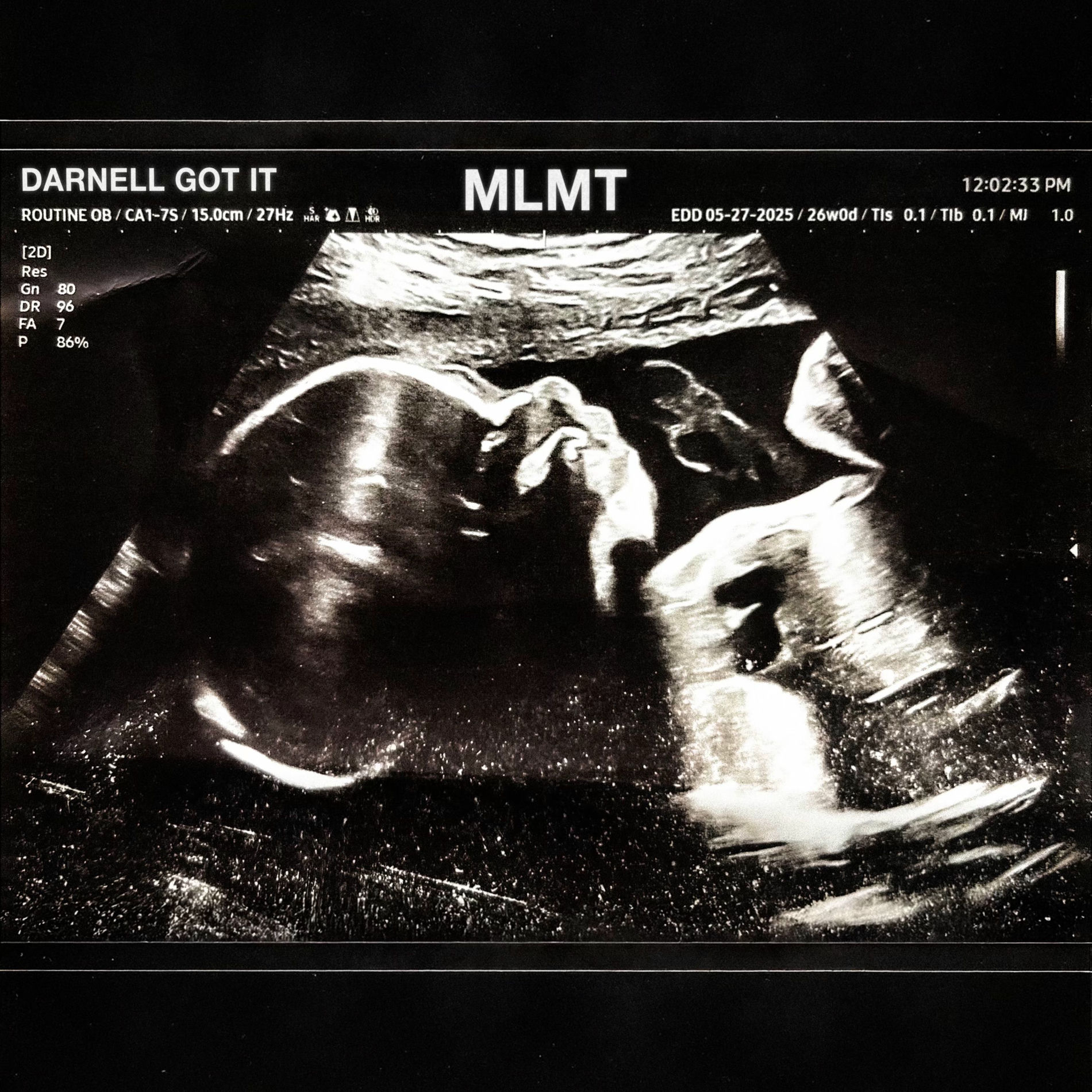 Album cover of MLMT