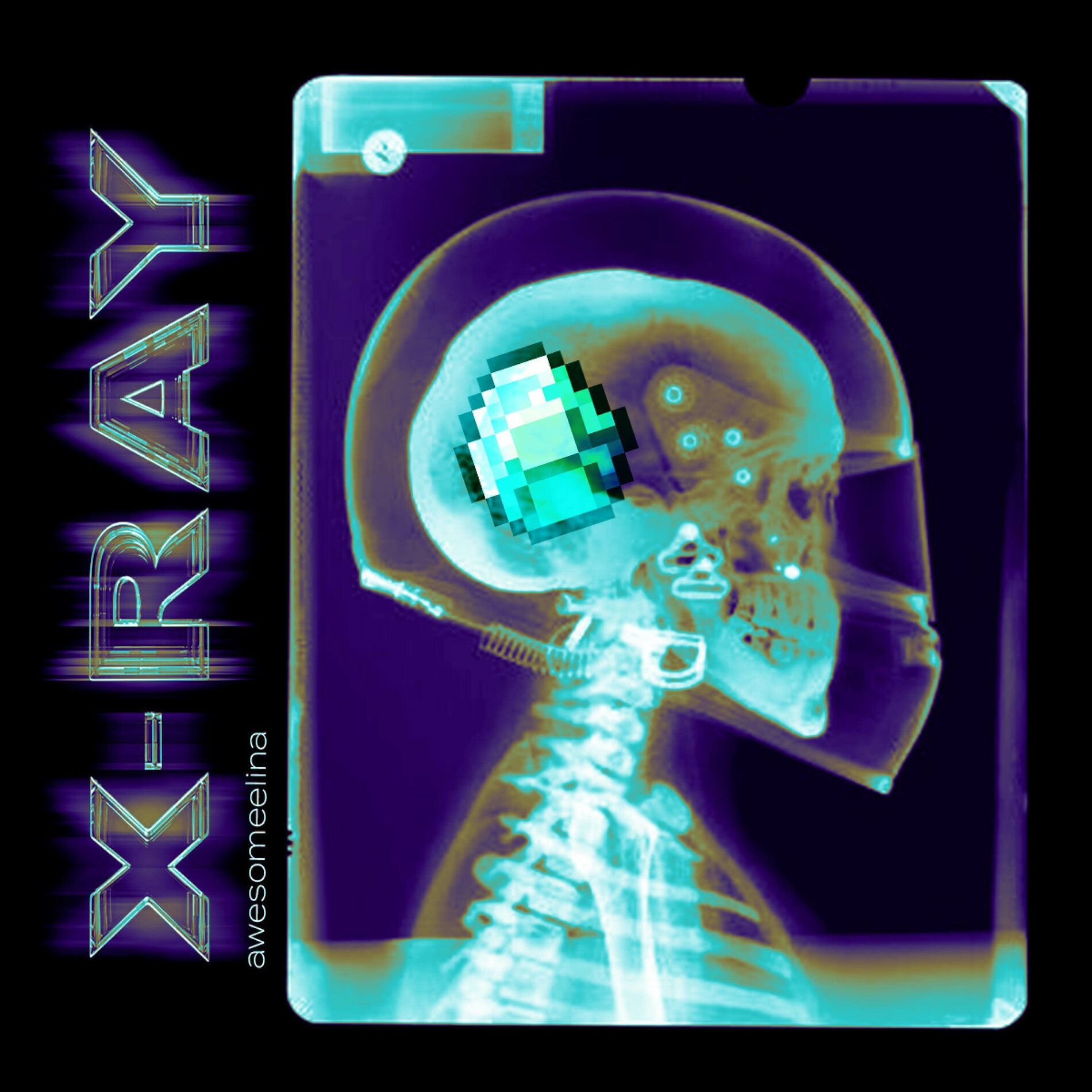 Album cover of X-RAY