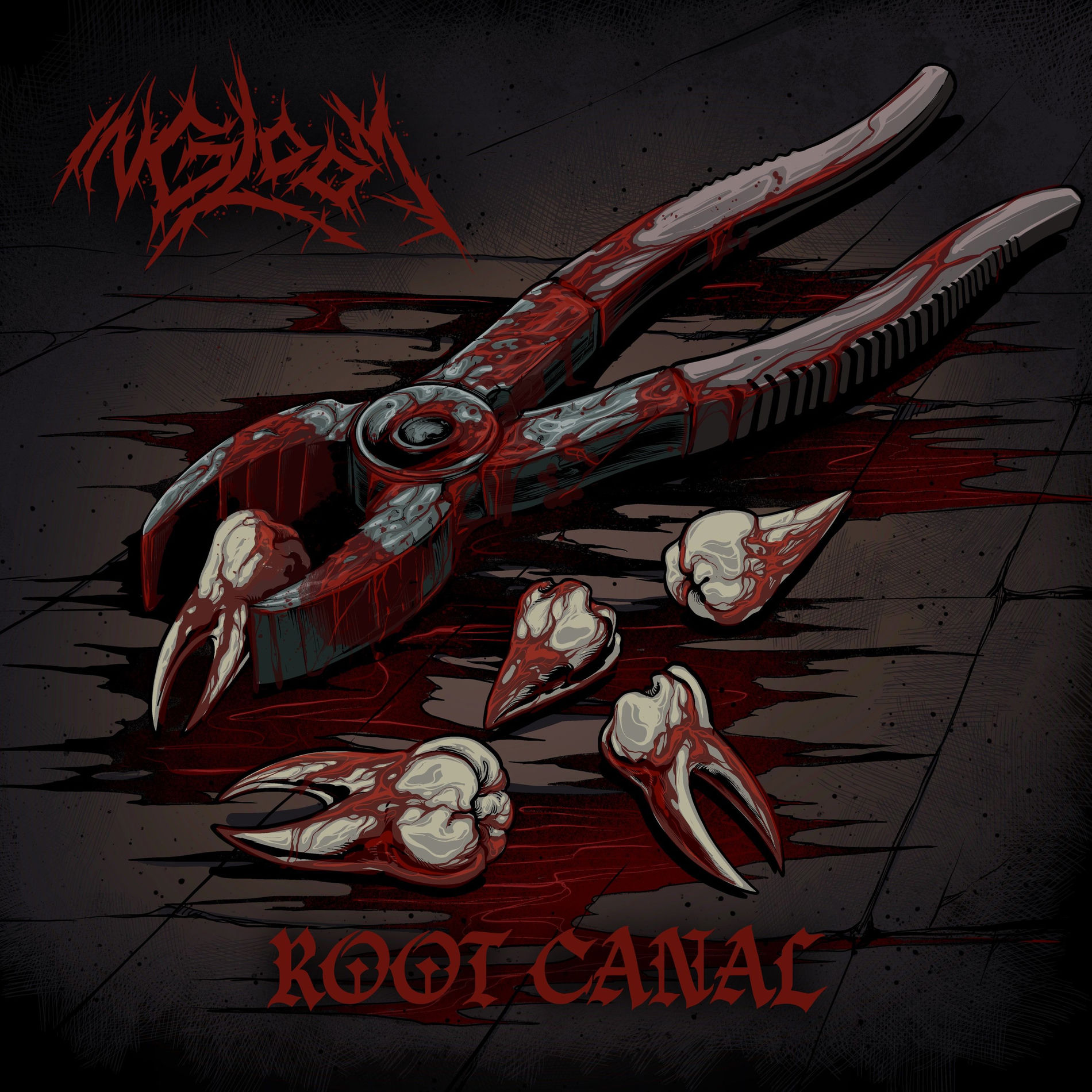 Album cover of Root Canal