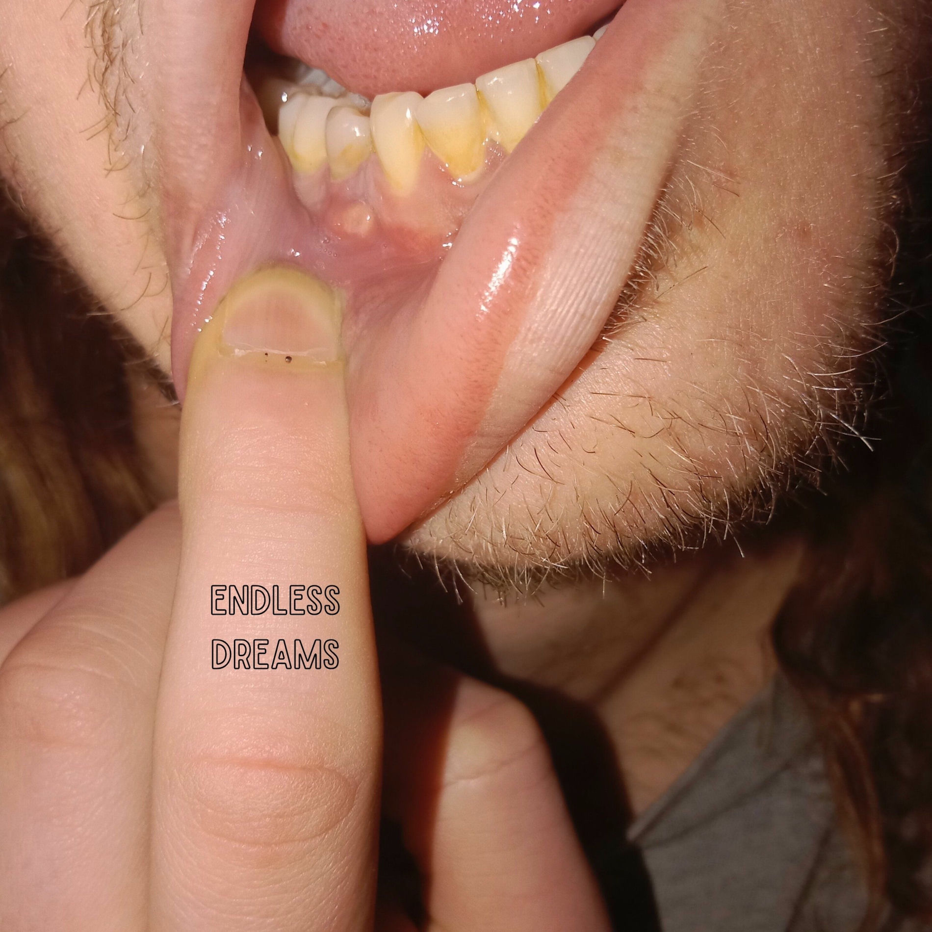 Album cover of Endless Dreams