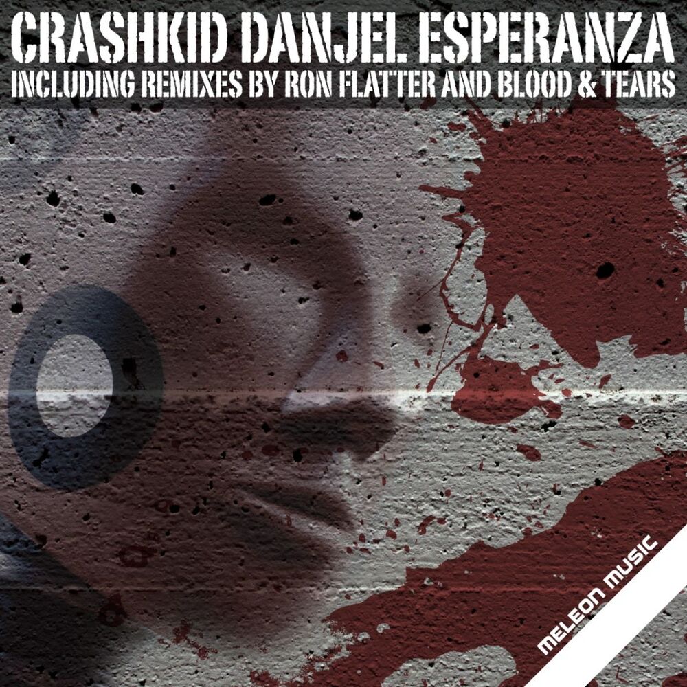 Picture of Crashkid