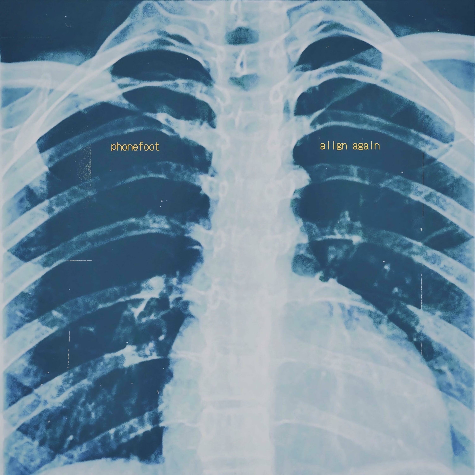Album cover of Align Again