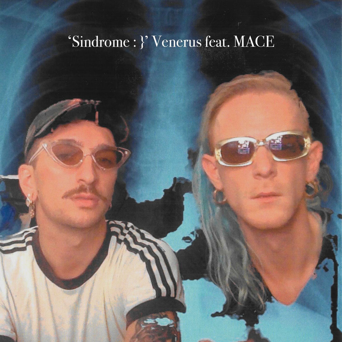 Album cover of Sindrome