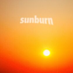 Sunburn