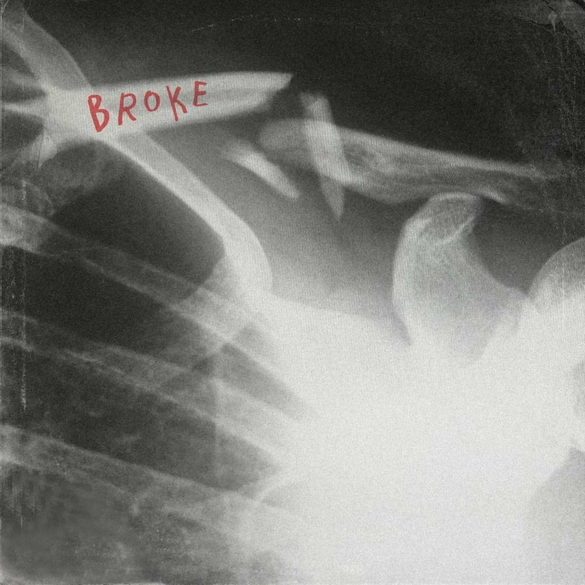 Album cover of BROKE