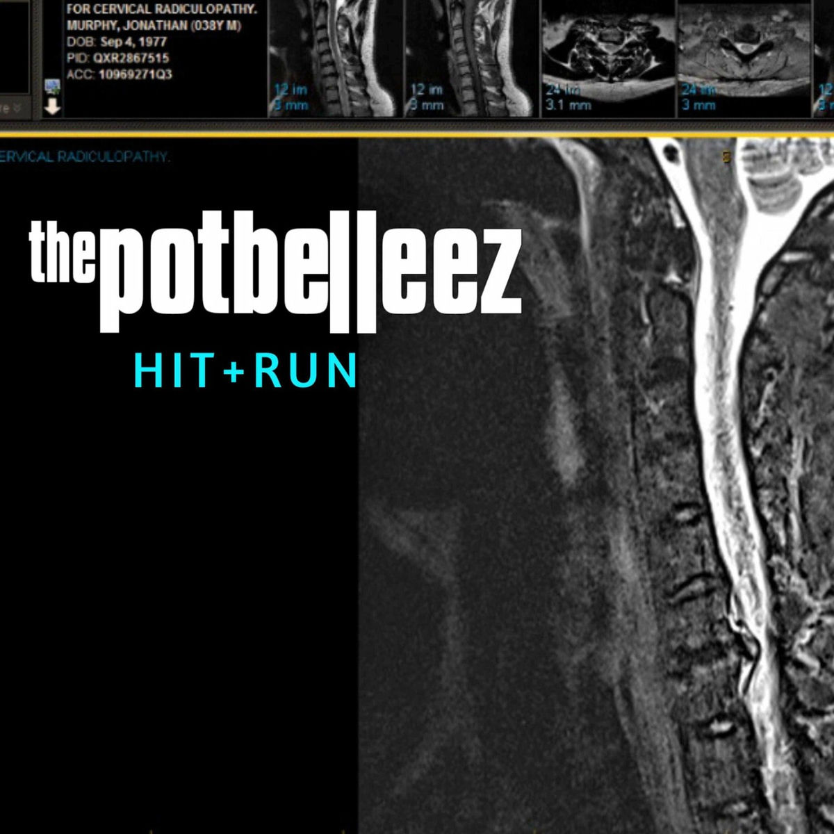 Album cover of Hit & Run