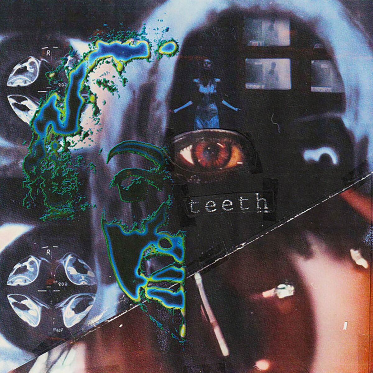 Album cover of teeth (you)