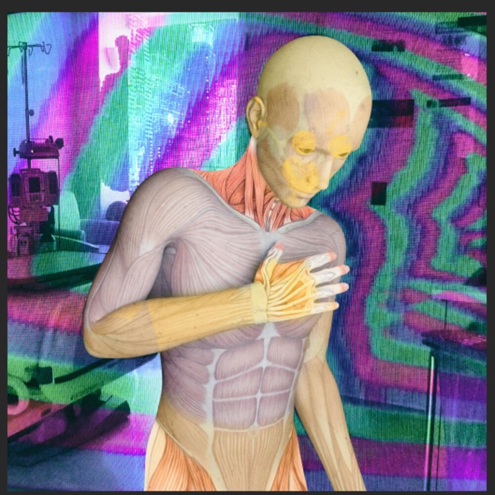 Picture of Akathisia