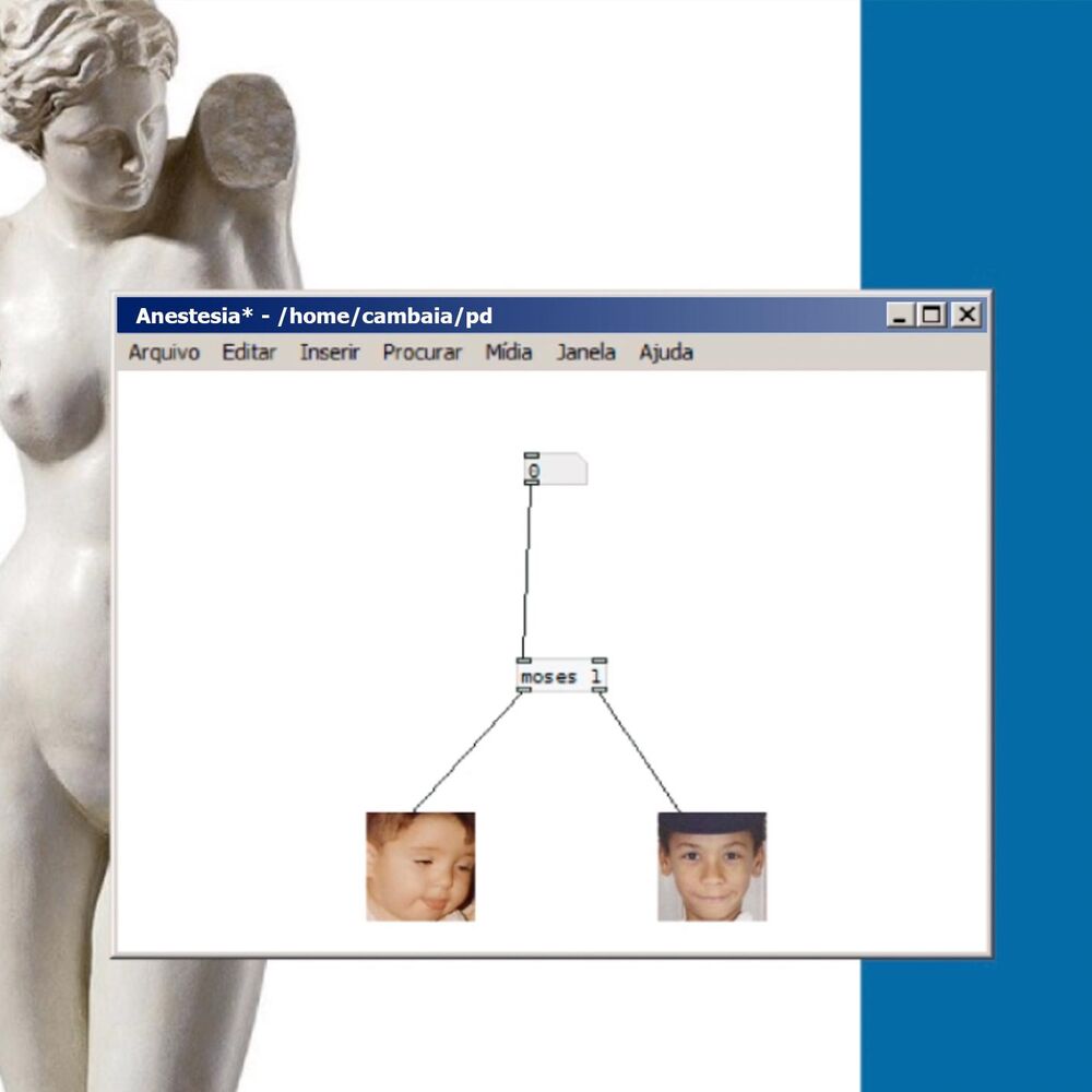 Picture of Anestesia