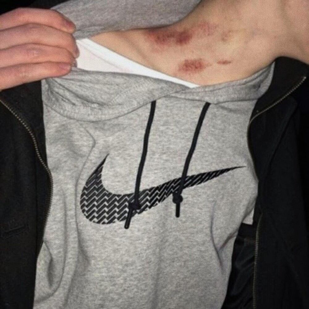 Picture of Scars