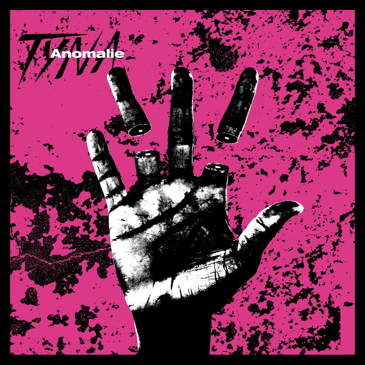 Album cover of Anomalie