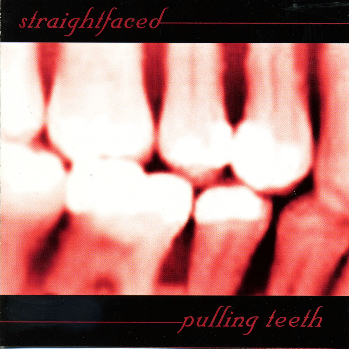 Album cover of Pulling Teeth