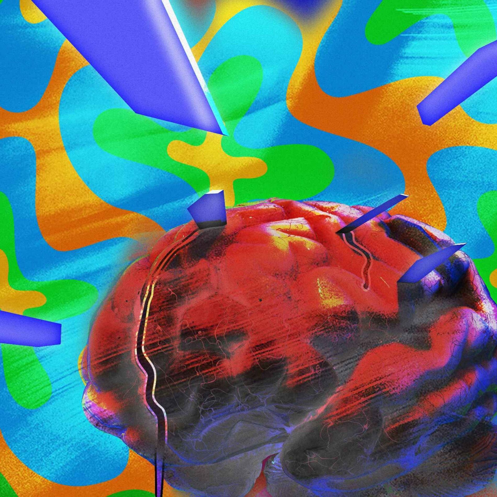 Album cover of AUTISM