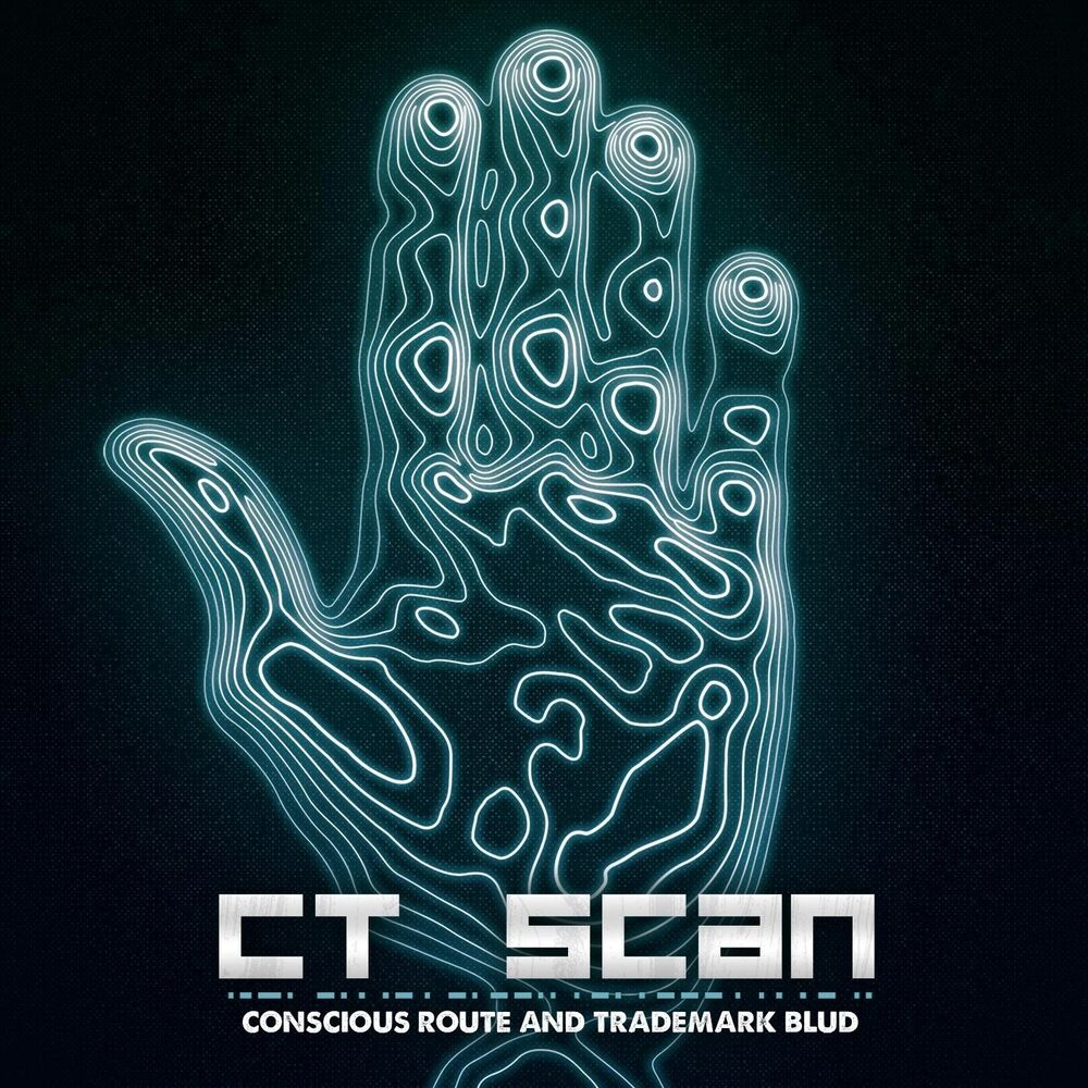 Picture of CT Scan