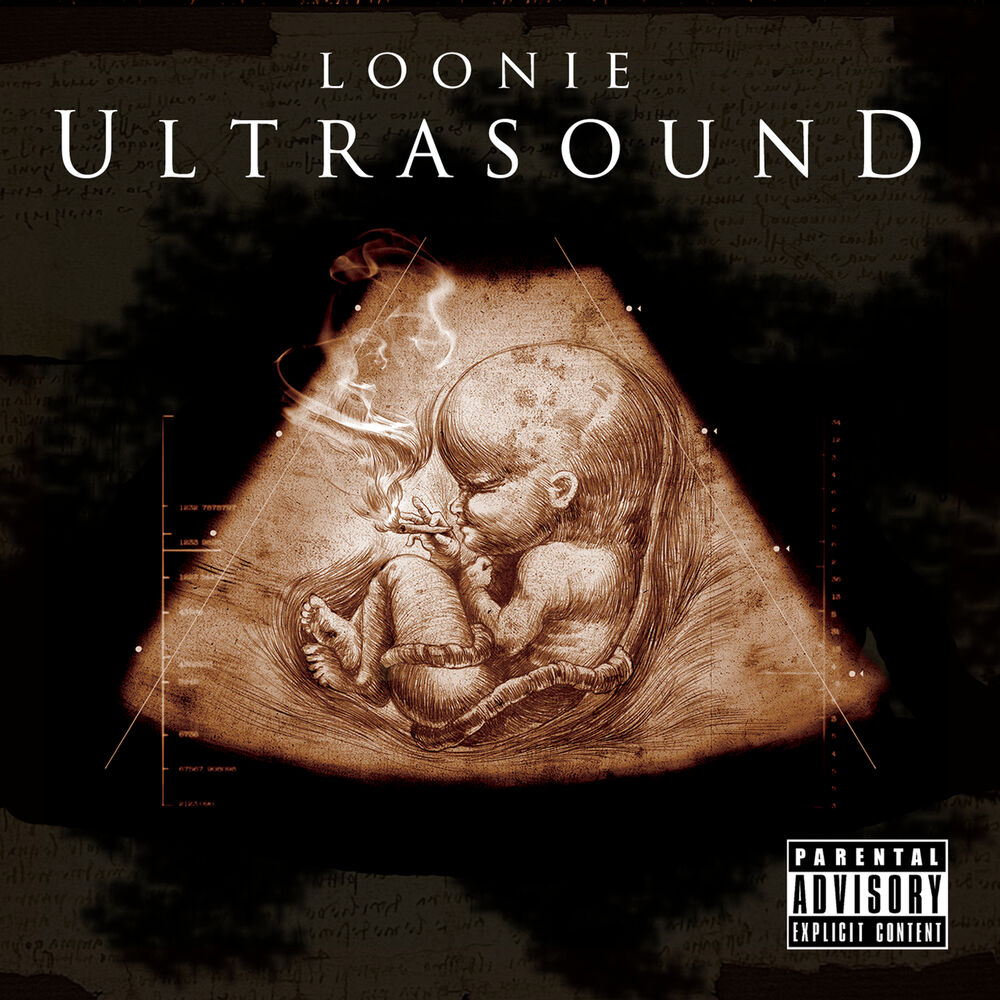Picture of Ultrasound