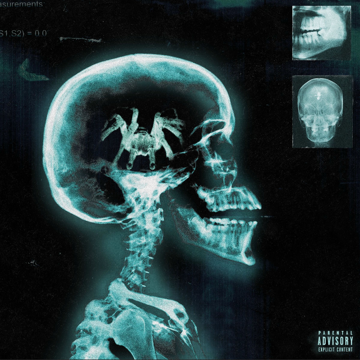 Album cover of Tarantula