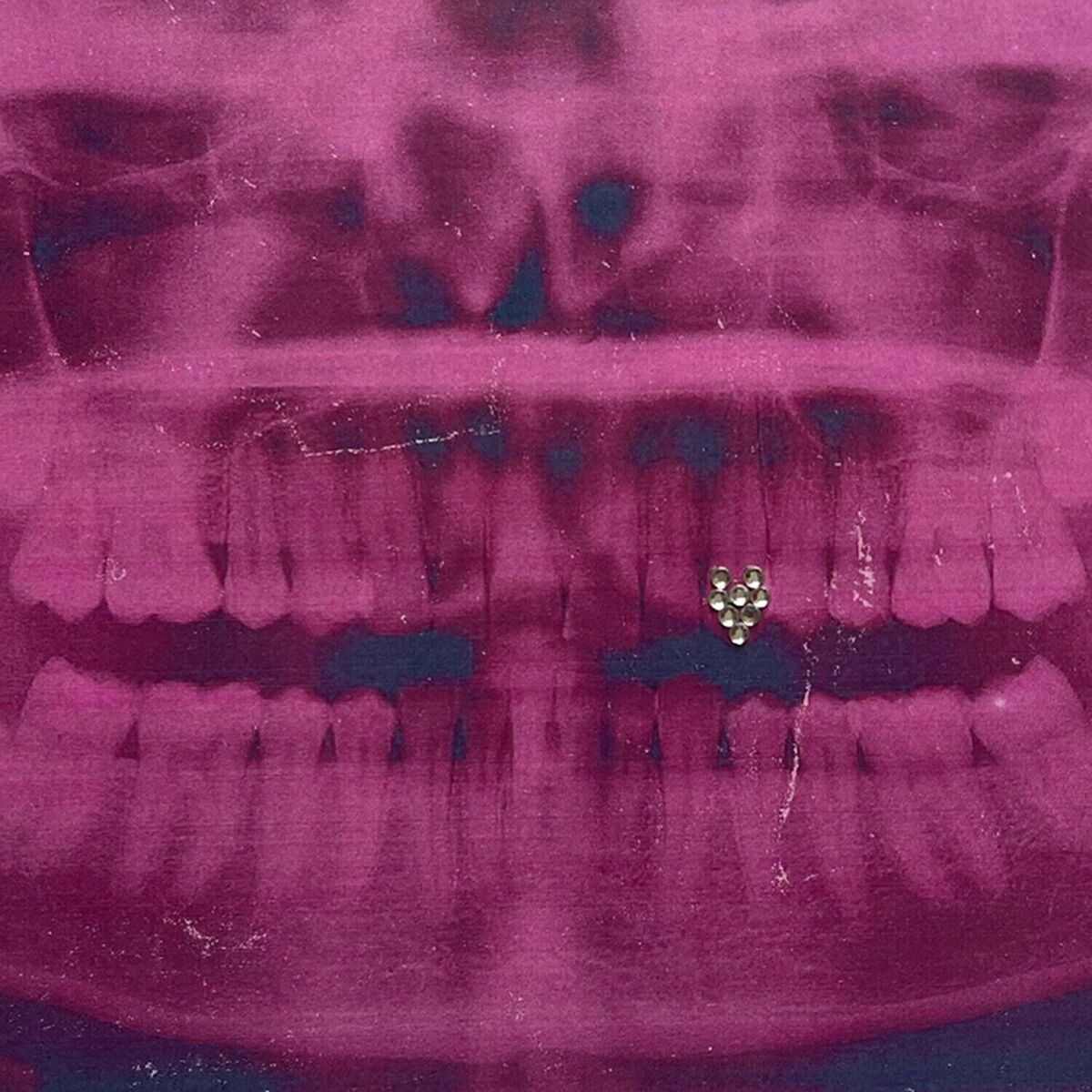Album cover of BRILLO EN LOS DIENTES